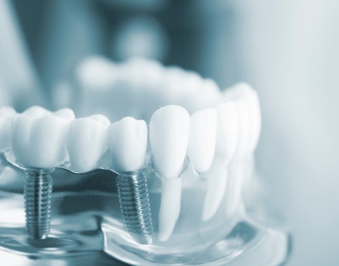 What are the qualifications and experience of dentists in Chattanooga?