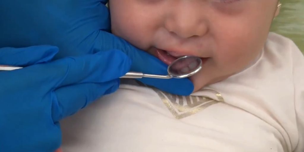 Dientes de bebé