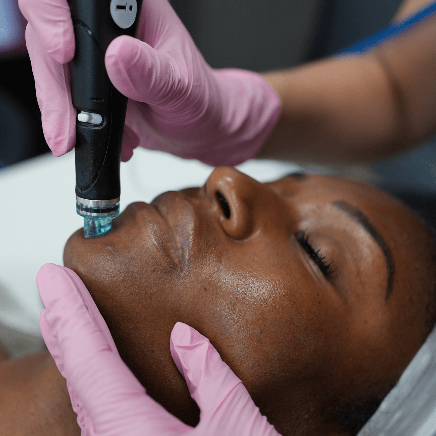 Hydrafacial