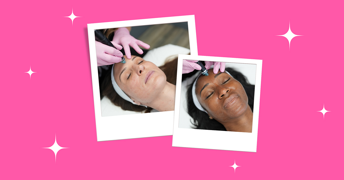 Laser away image for 5 Reasons Why You Should Try Hydrafacials