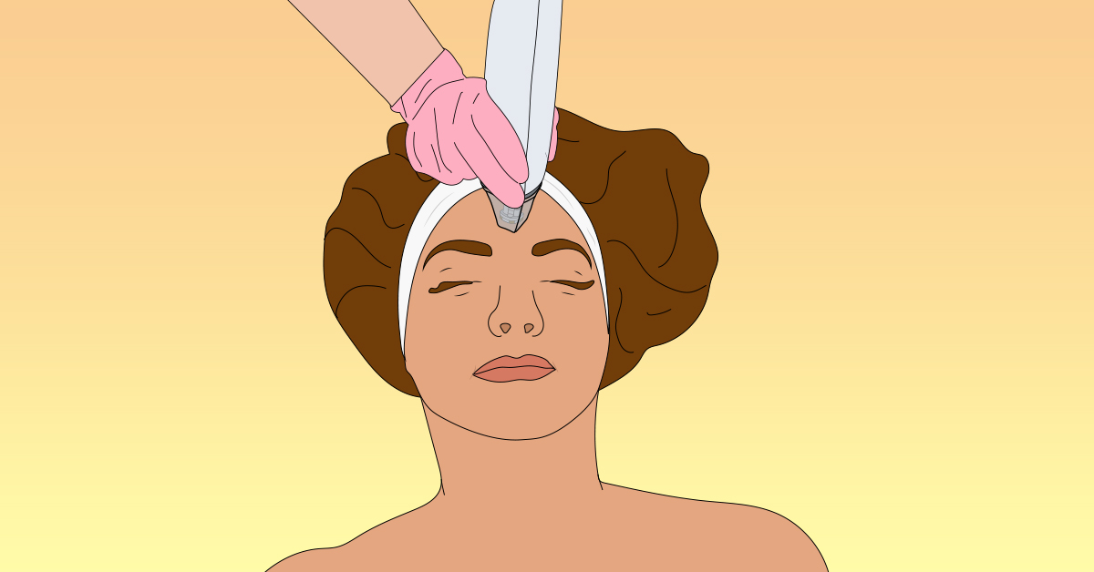 Laser away post image for Treatment Diary: Trying Out Potenza™ RF Microneedling
