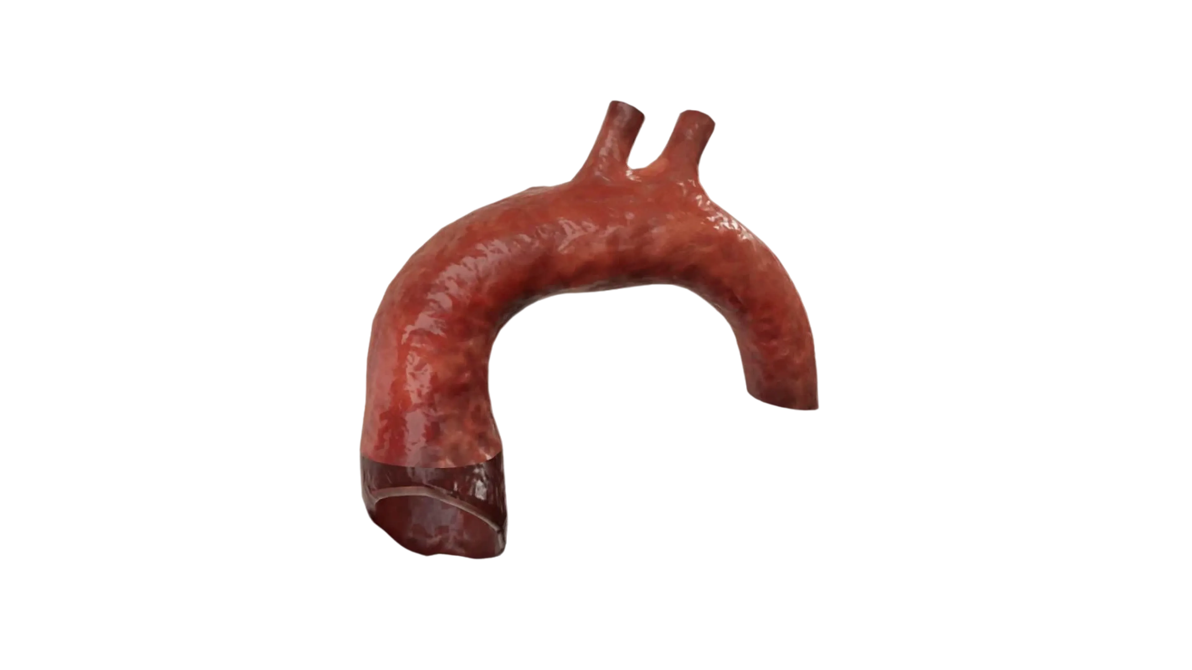 Aorta