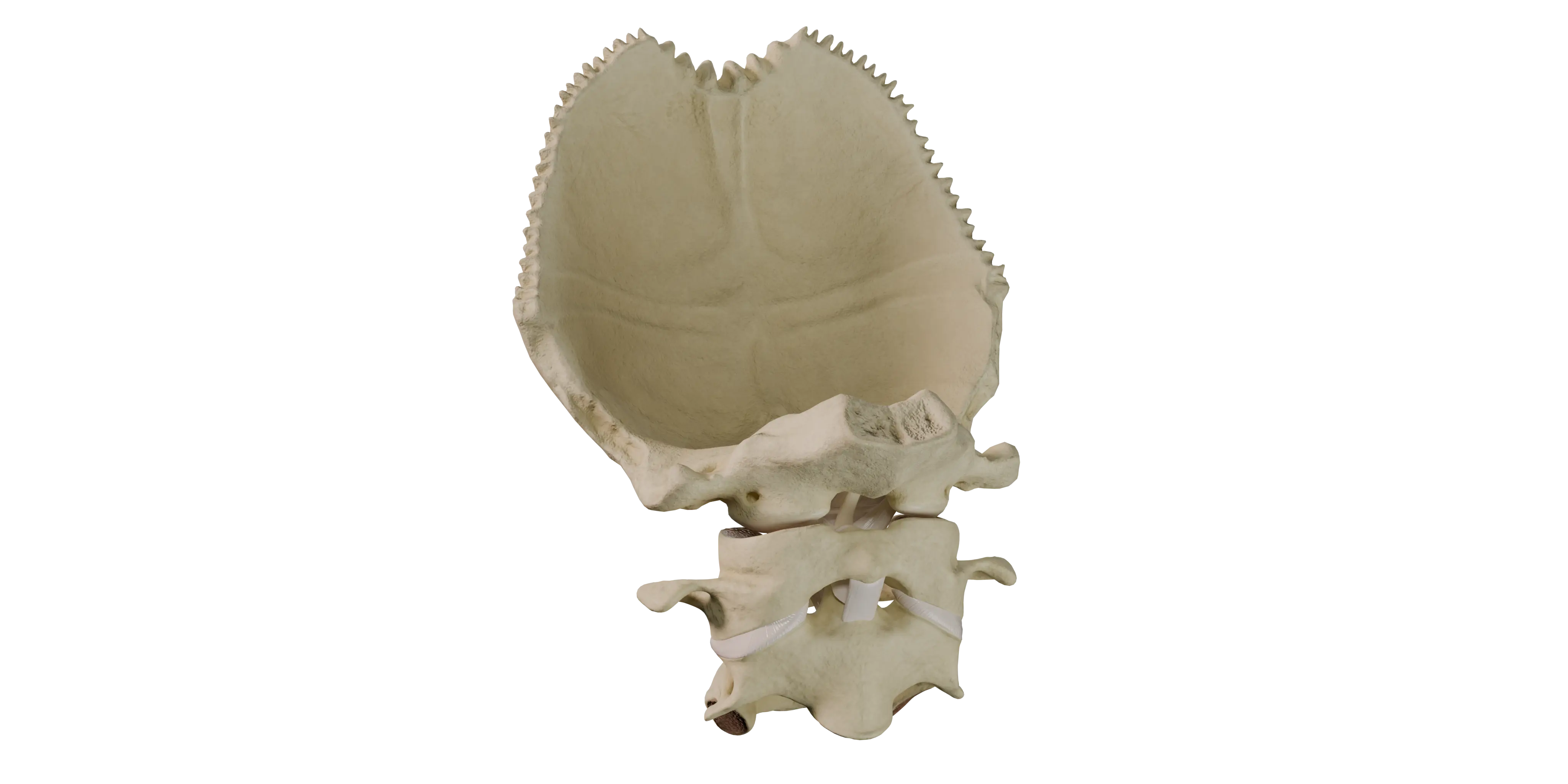 Atlantoaxial Joints (Median and Lateral)
