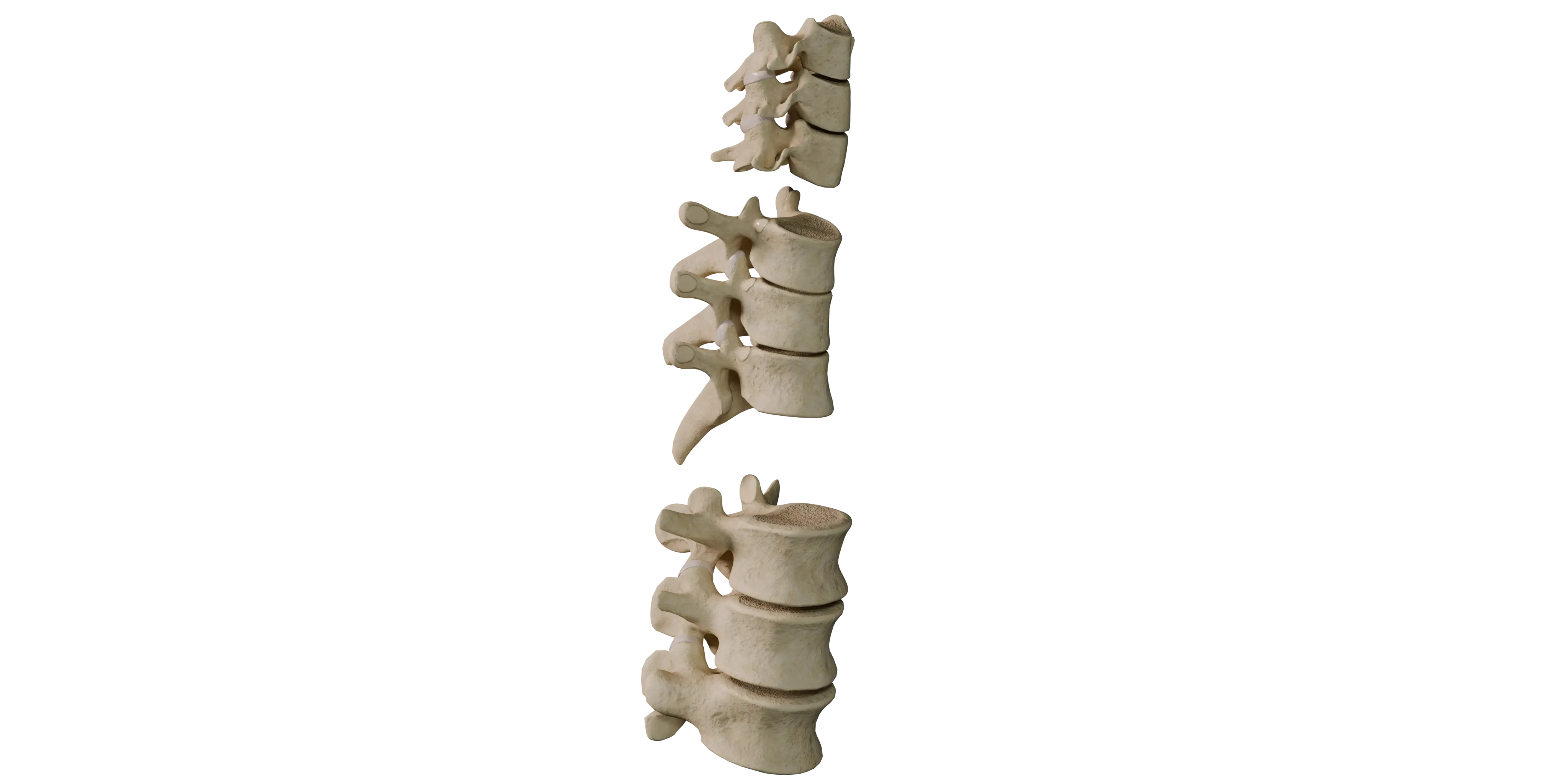 3D Model of Zygapophyseal Joints (Facet Joints)