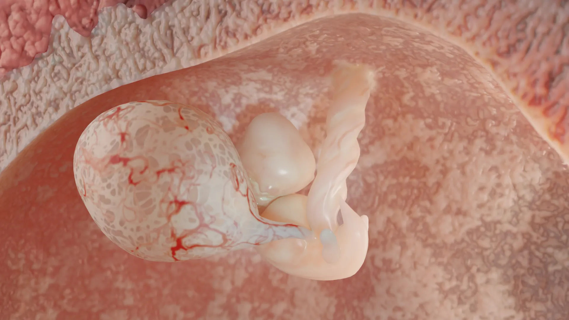 Grossesse unique (premier trimestre)