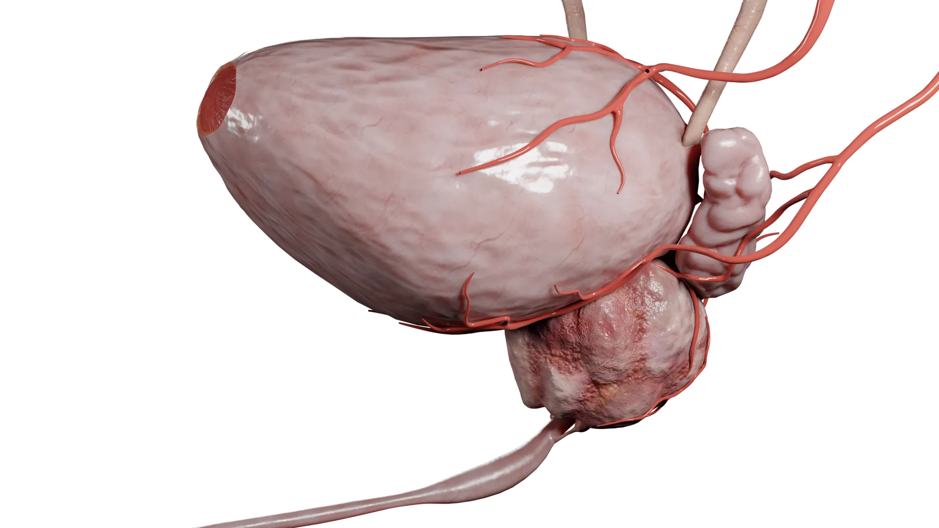 Trastornos de próstata