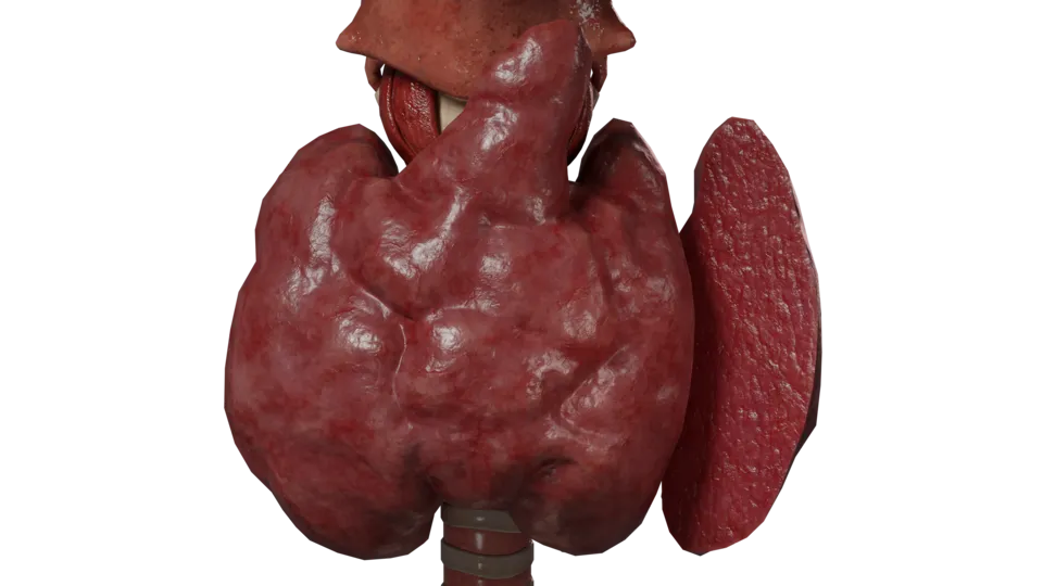 Crise thyroïdienne ou tempête thyroïdienne