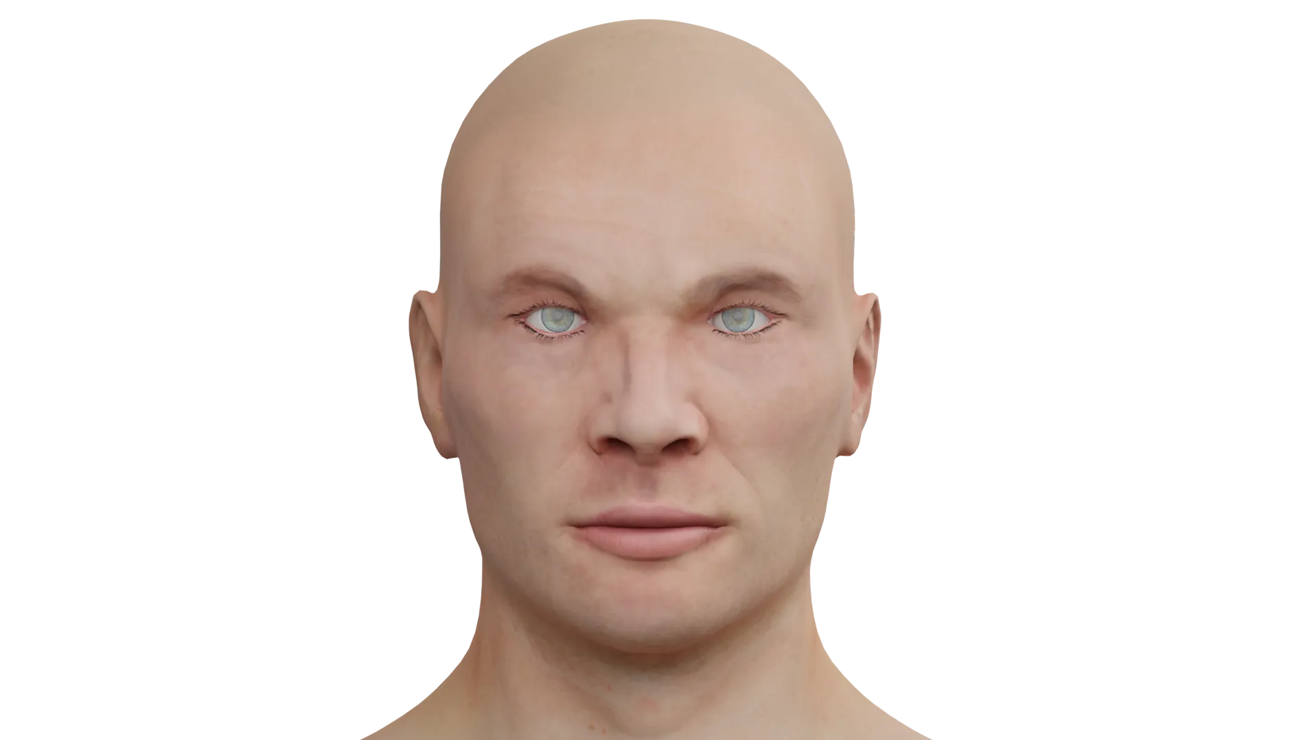 Blefarofimosi