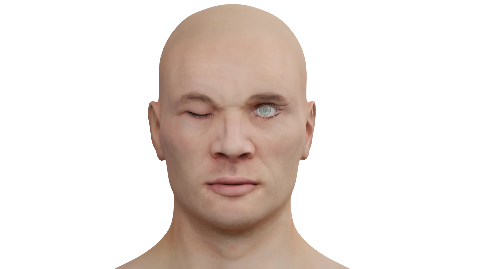 Modello di lagioftalmo