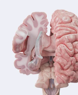 Pathology conditions model