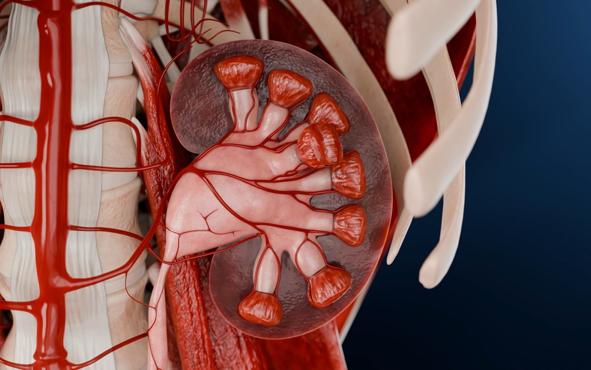 Hydronephrosis