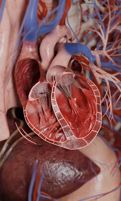 Cardiomiopatia dilatativa