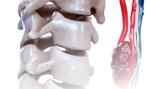 Neck image