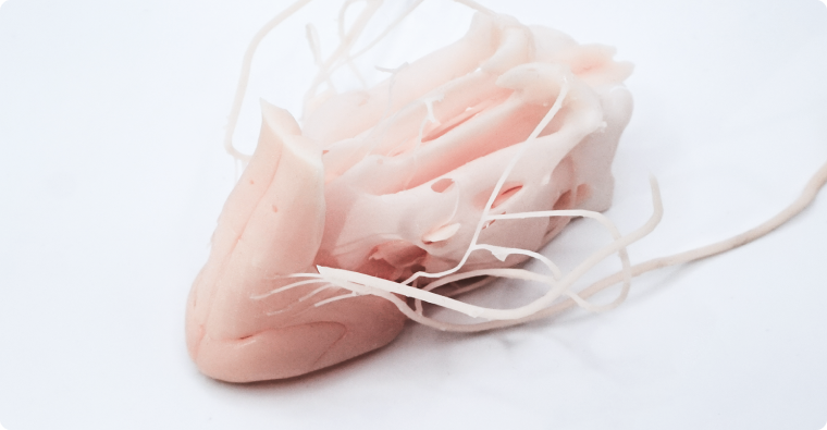 3D printable anatomical models 