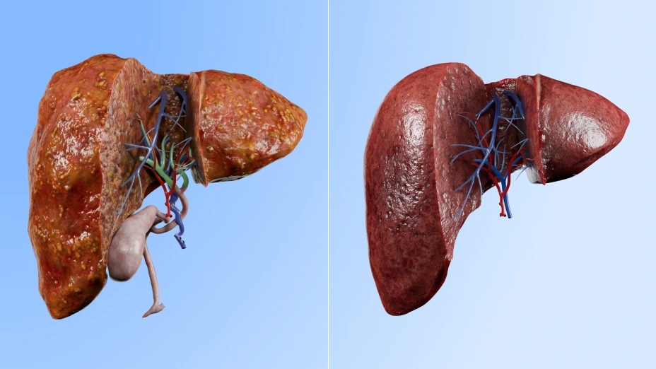 VOKA 3D models for anatomy and pathology teaching