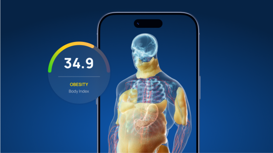 Conteúdo para aplicativos de fitness