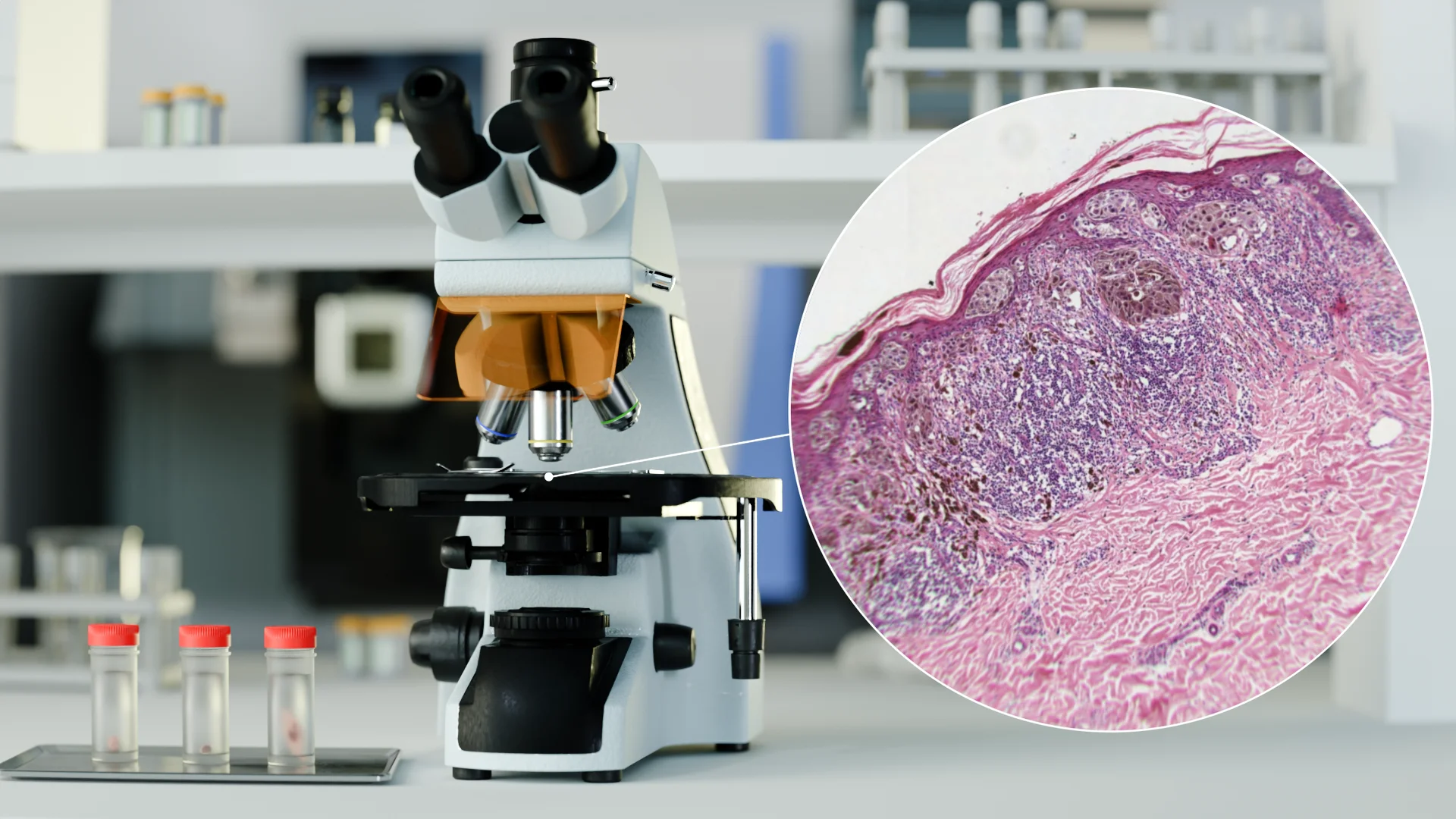 A laboratory setting featuring a microscope focused on a magnified 3D histology slide of a skin biopsy, revealing the cellular structure of the epidermis and dermis.