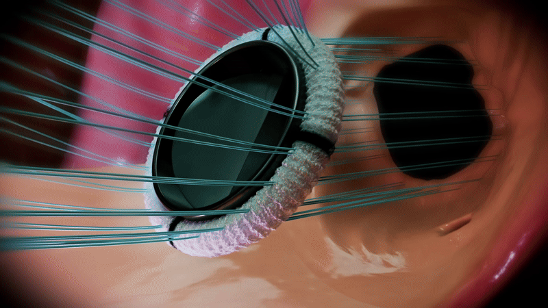 Riflessioni finali sull'uso della realtà virtuale in ambito sanitario