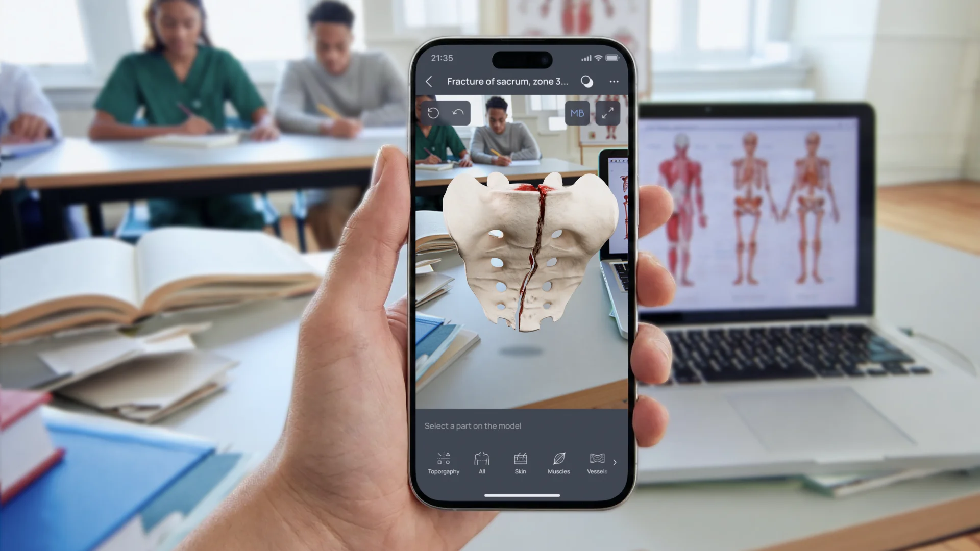 A first-person view of a medical student holding a smartphone to examine a detailed AR model of a fractured sacrum, demonstrating how mobile extended reality apps facilitate interactive anatomical study in a classroom setting.
