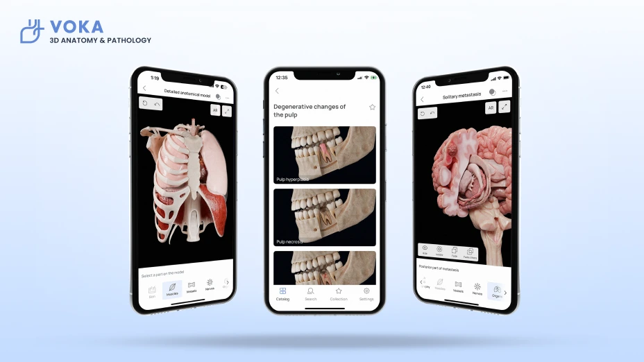 علم التشريح وعلم الأمراض VOKA 3D