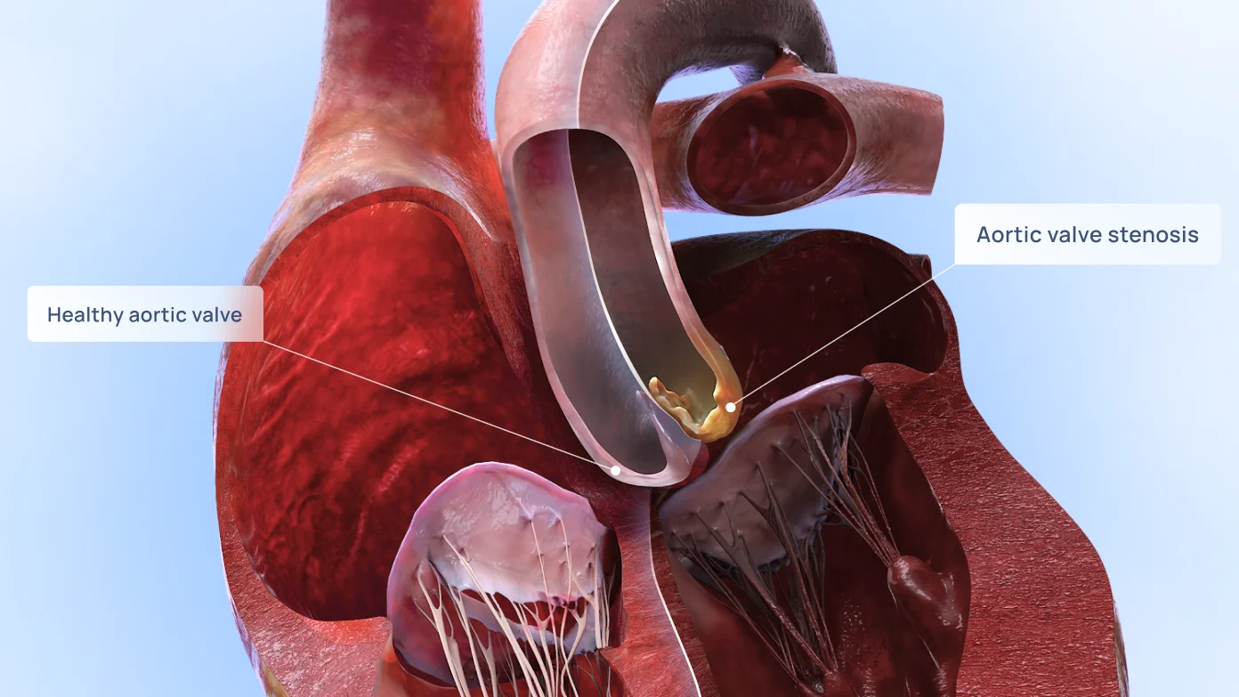 How to study pathology and pathophysiology: tips for efficient learning