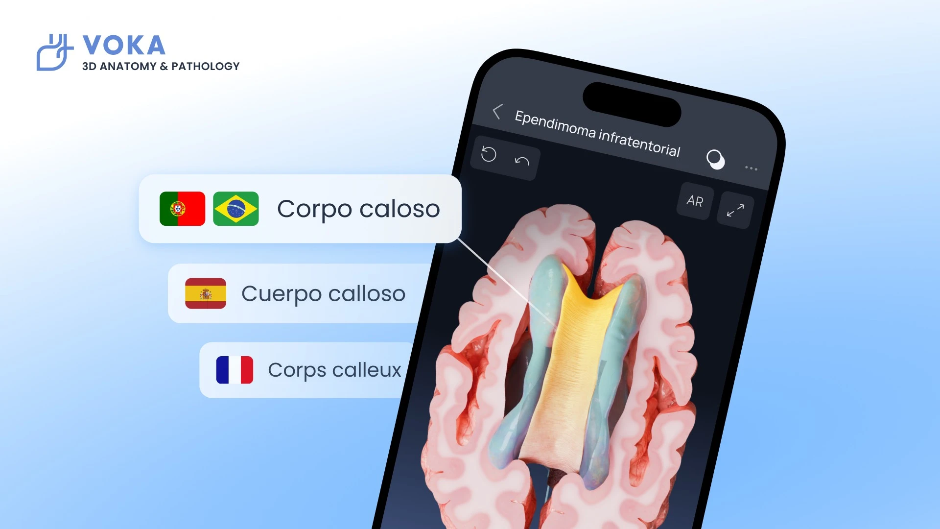  VOKA 3D Anatomy & Pathology now speaks French, Spanish, and Portuguese