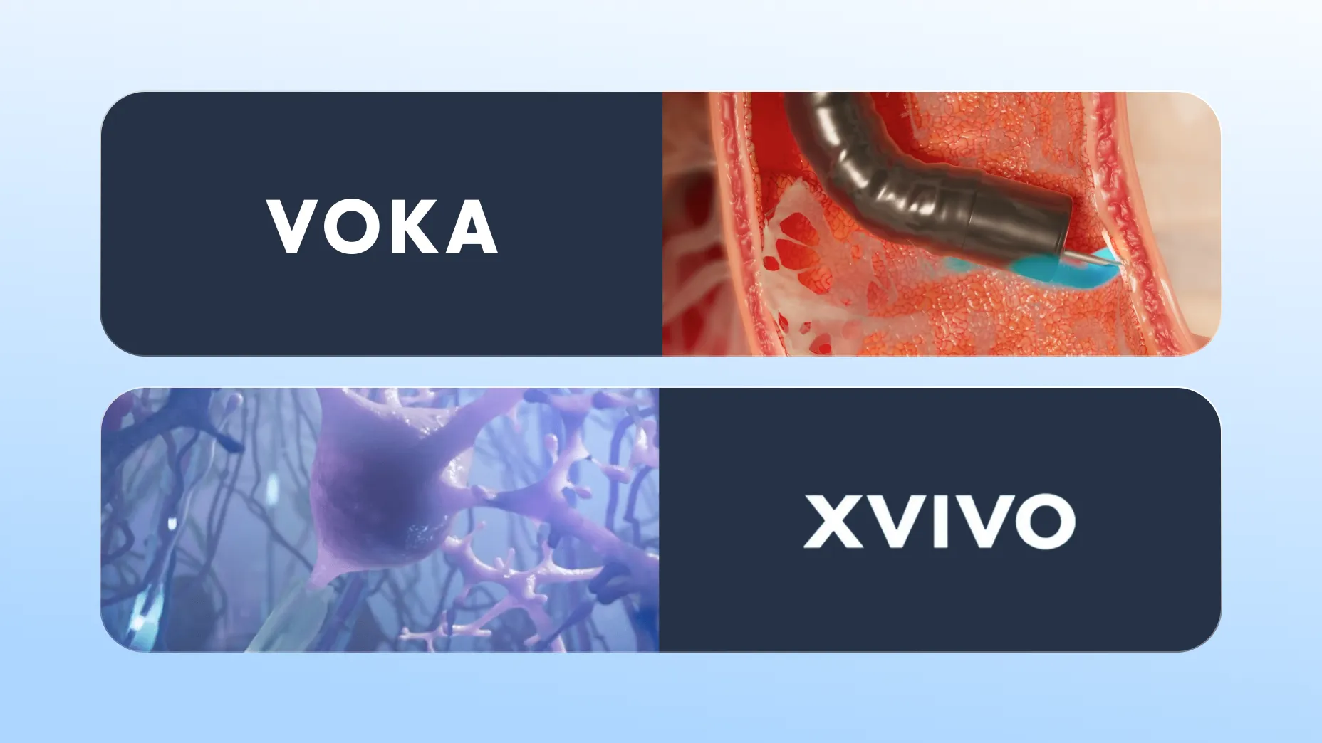 Wie Sie je nach Bedarf zwischen VOKA und XVIVO, zwei Unternehmen für medizinische 3D-Animationen, wählen können