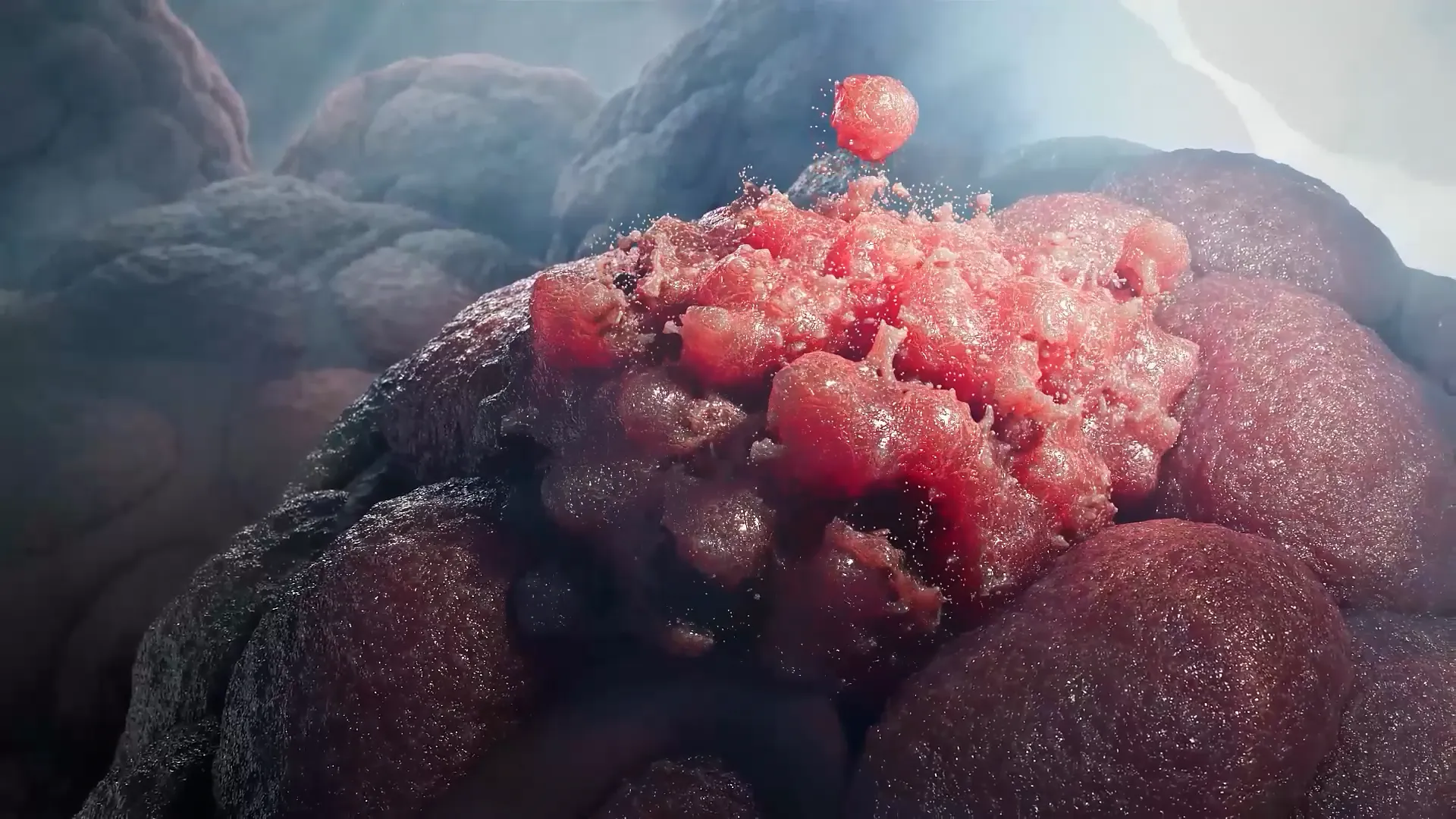 Carcinoma mammario HER2-positivo