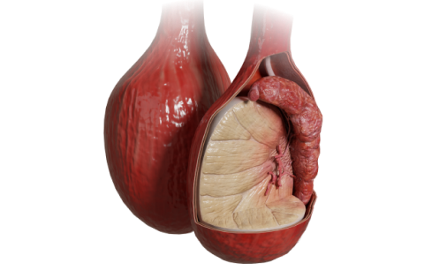 Download VOKA 3D Anatomy & Pathology