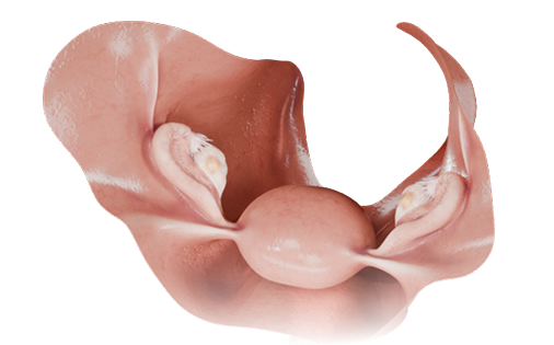Download VOKA 3D Anatomy & Pathology