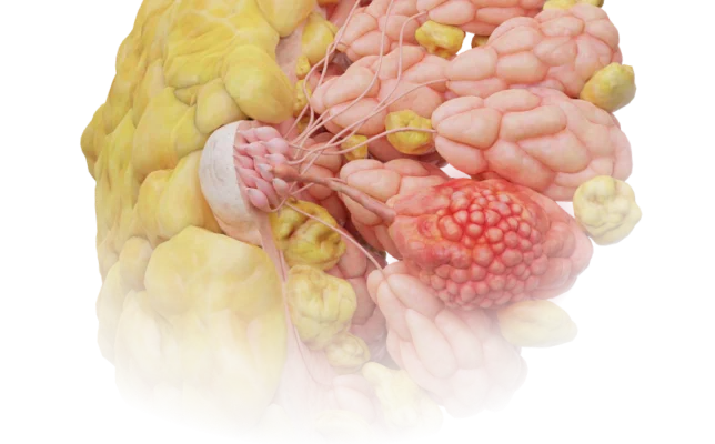 Download VOKA 3D Anatomy & Pathology