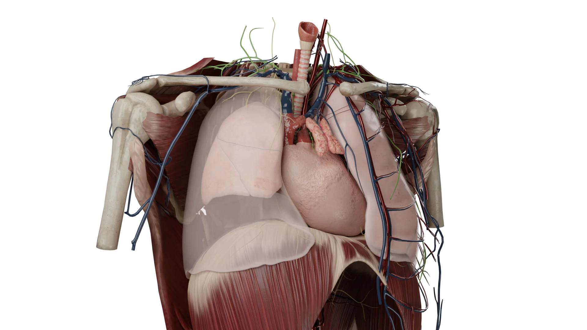 Pneumothorax droit ouvert