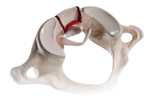Download VOKA 3D Anatomy & Pathology