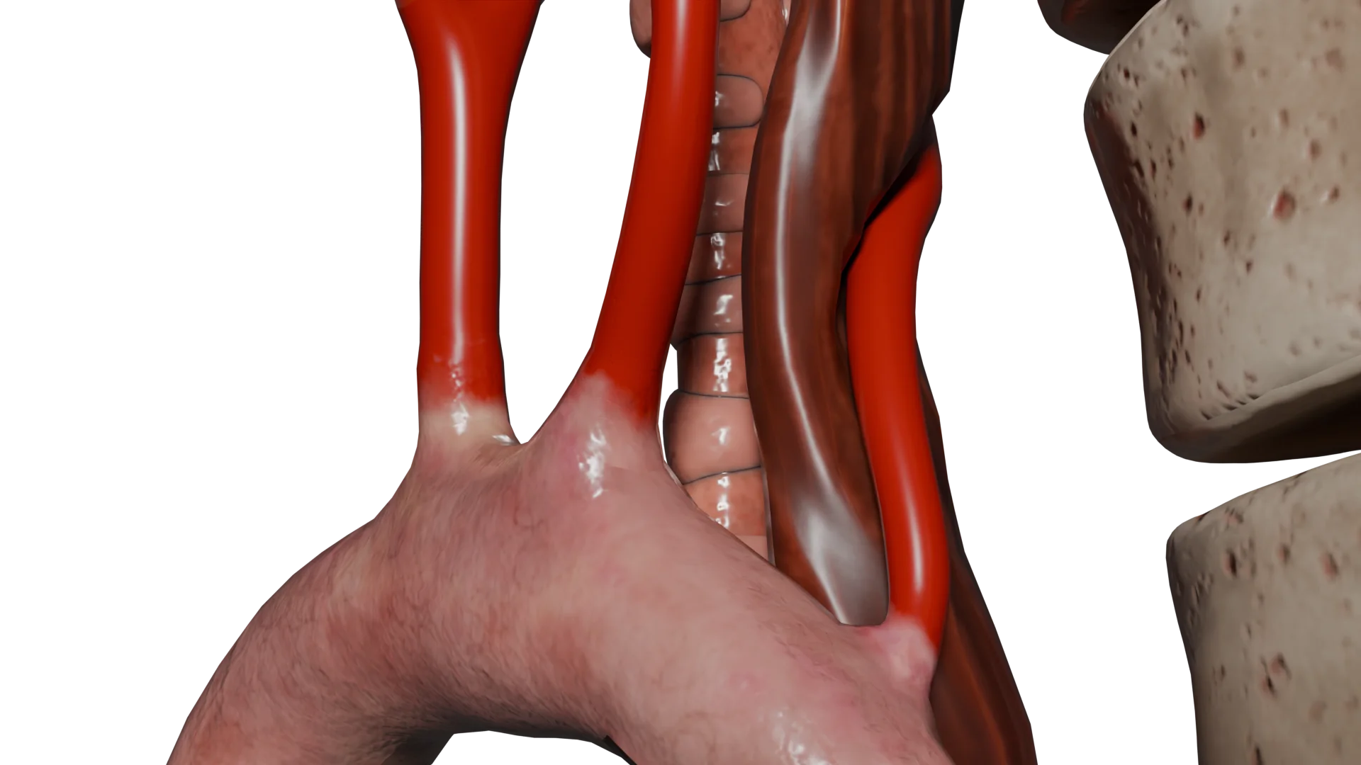En passant derrière l'œsophage, l'artère subclavière droite aberrante entraîne sa compression
