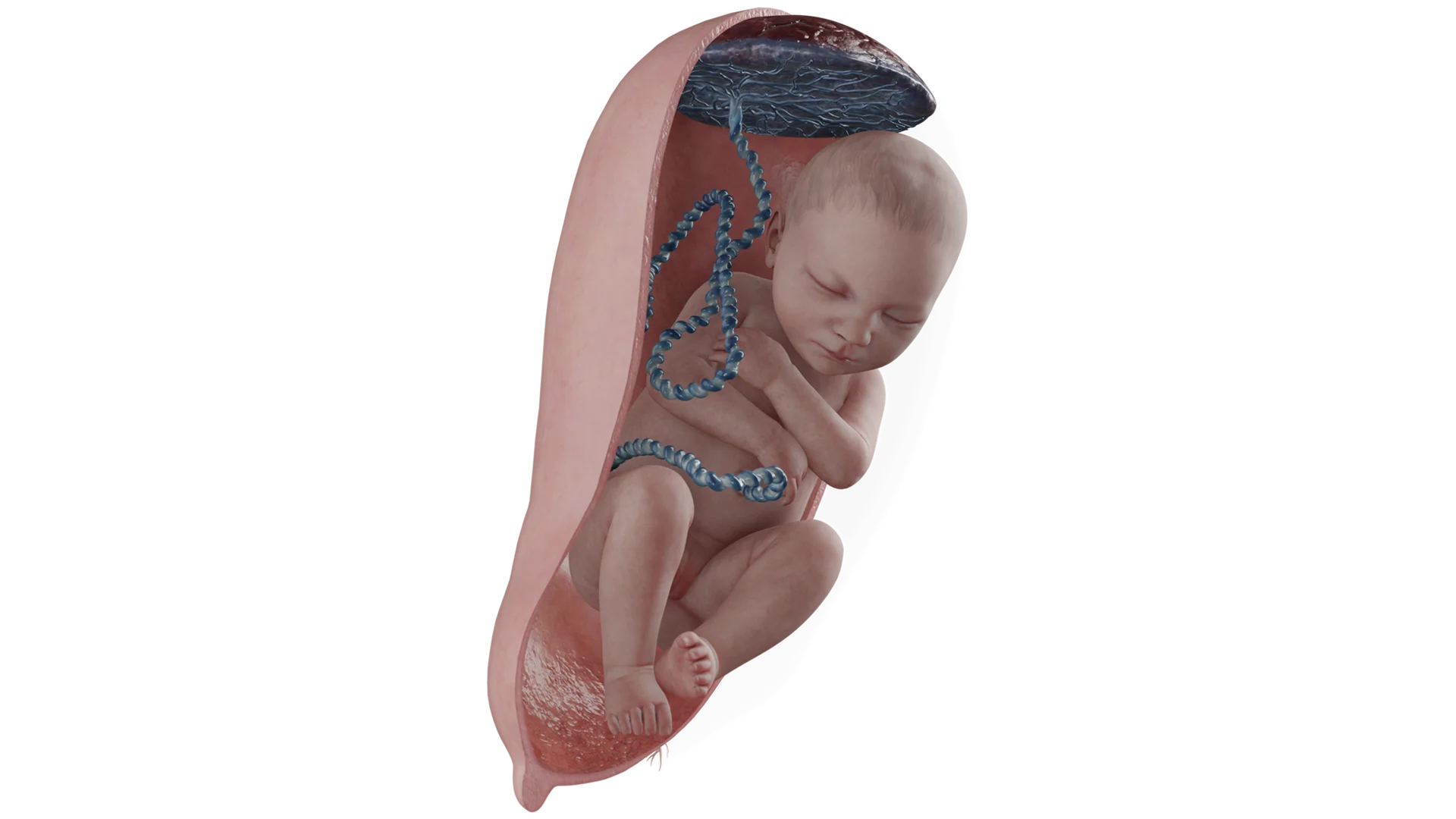 Full foot presentation of the fetus
