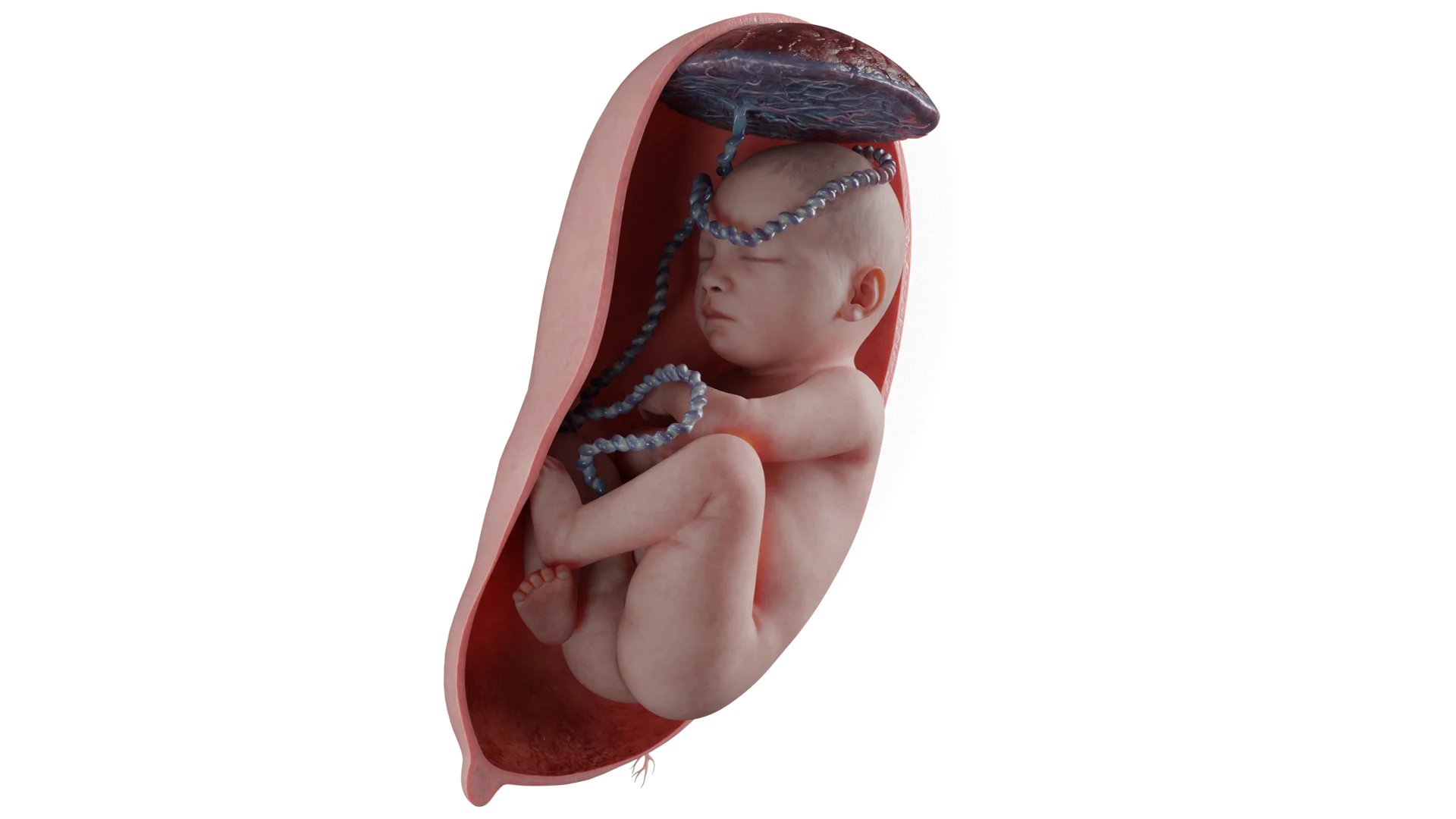 Mixed fetal presentation