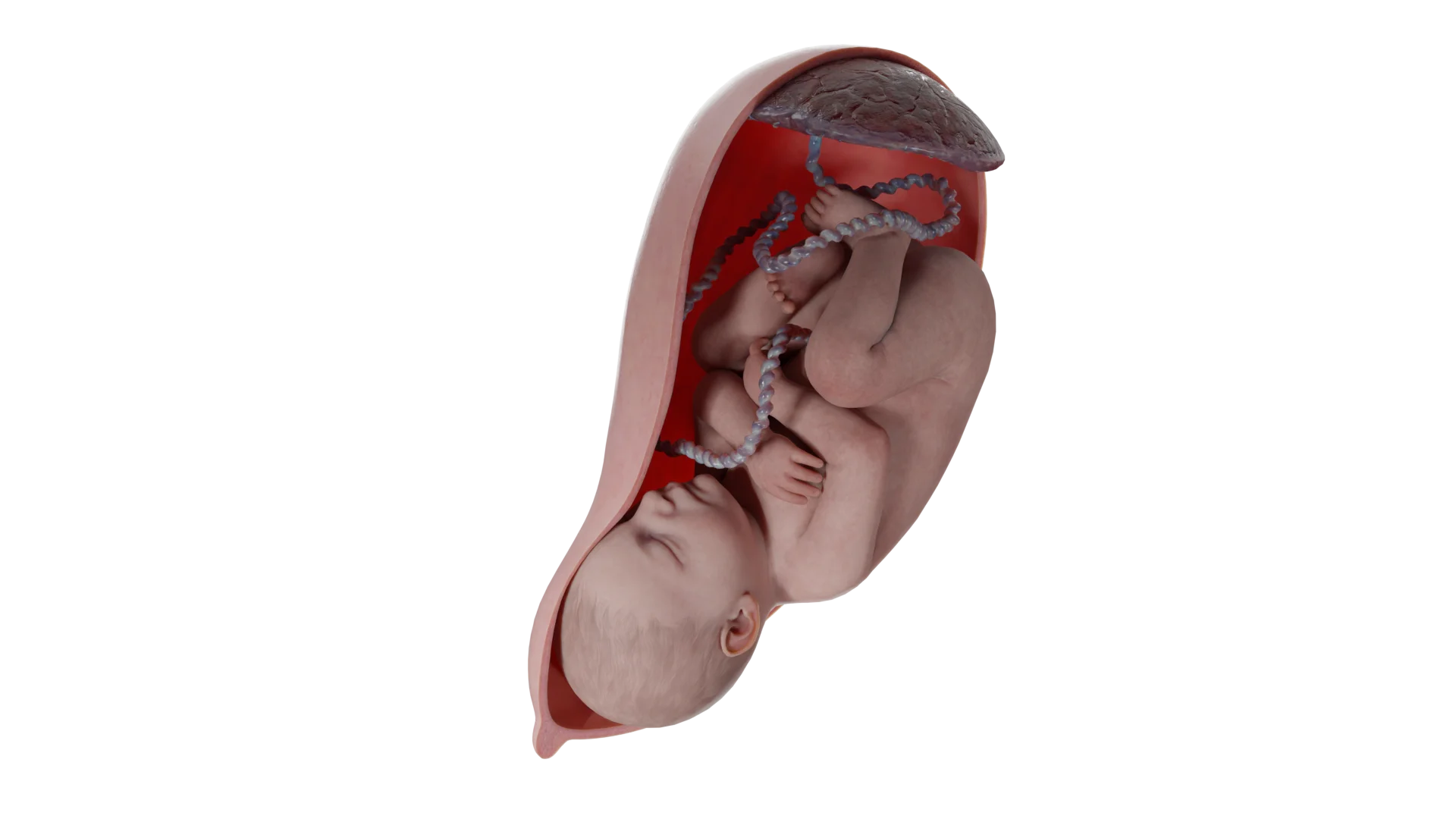 Feto, cordão umbilical, placenta na posição longitudinal da cabeça do feto