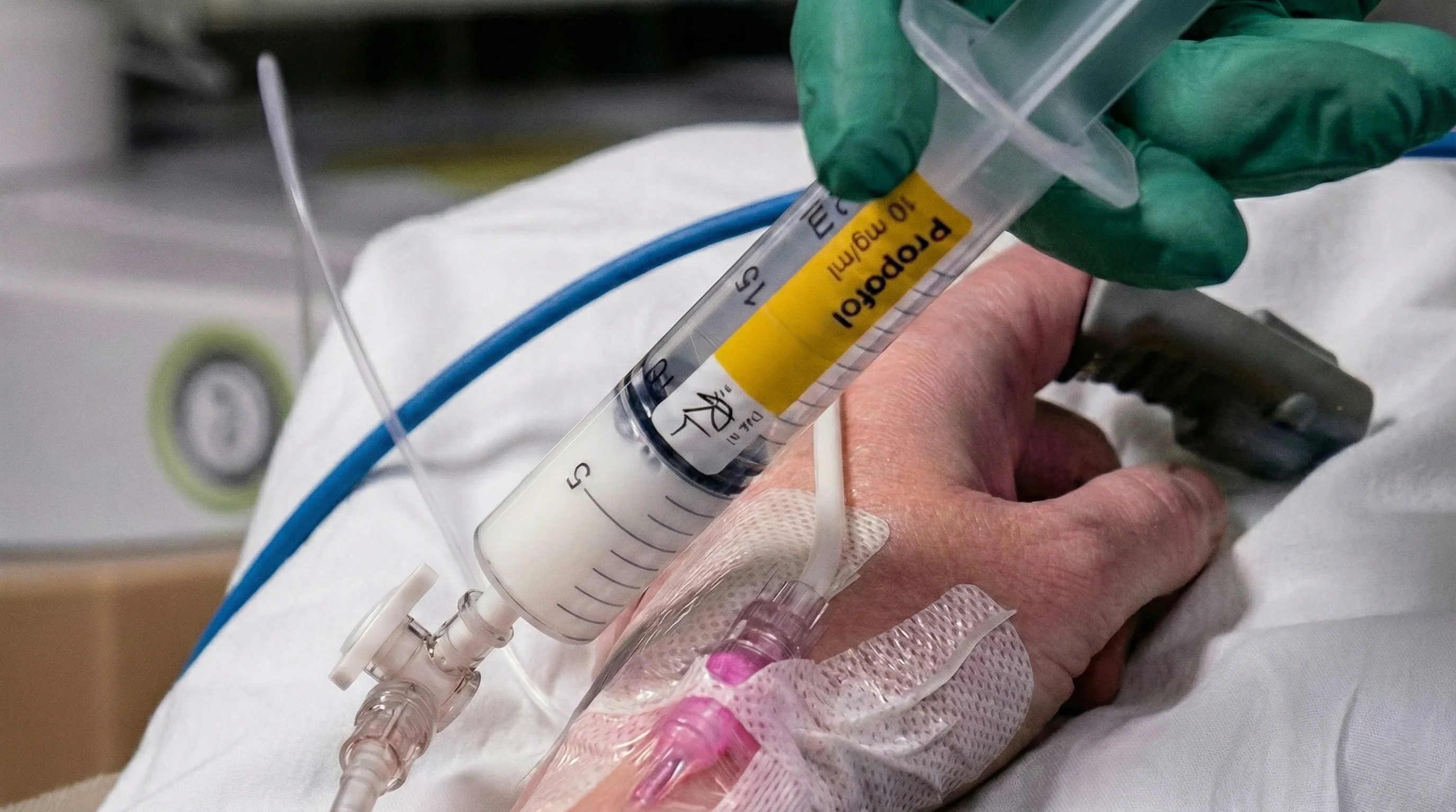 Быстрая последовательная индукция и интубация (RSI): факторы риска, показания и техника проведения