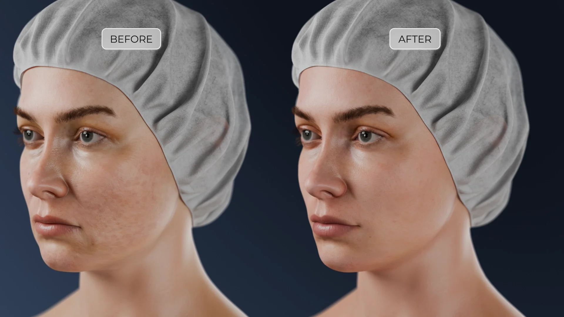 مقارنة بين الجلد قبل وبعد دورة من إجراءات الوخز بالإبر الدقيقة