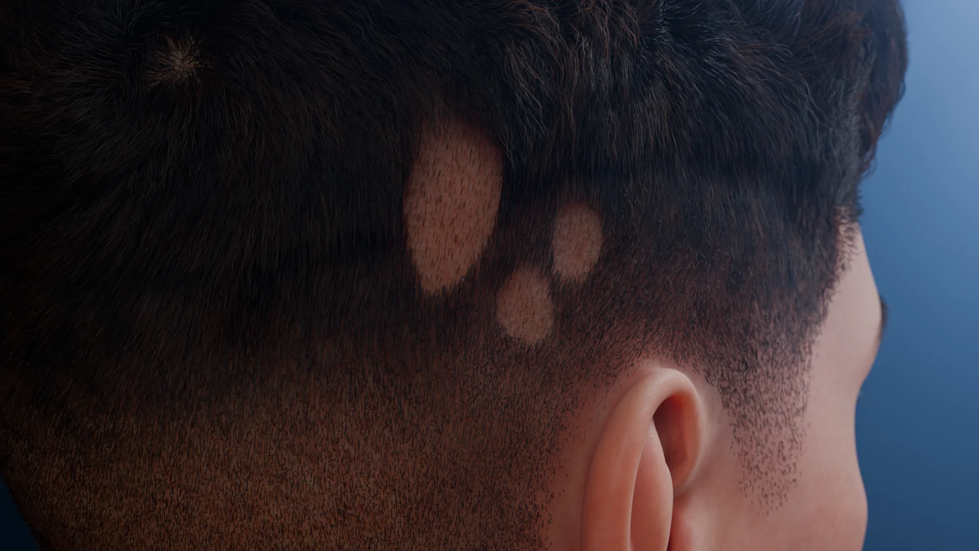 Ultraviolet Skin Imaging Using Wood’s Lamp: Principle, Indications, and Applications