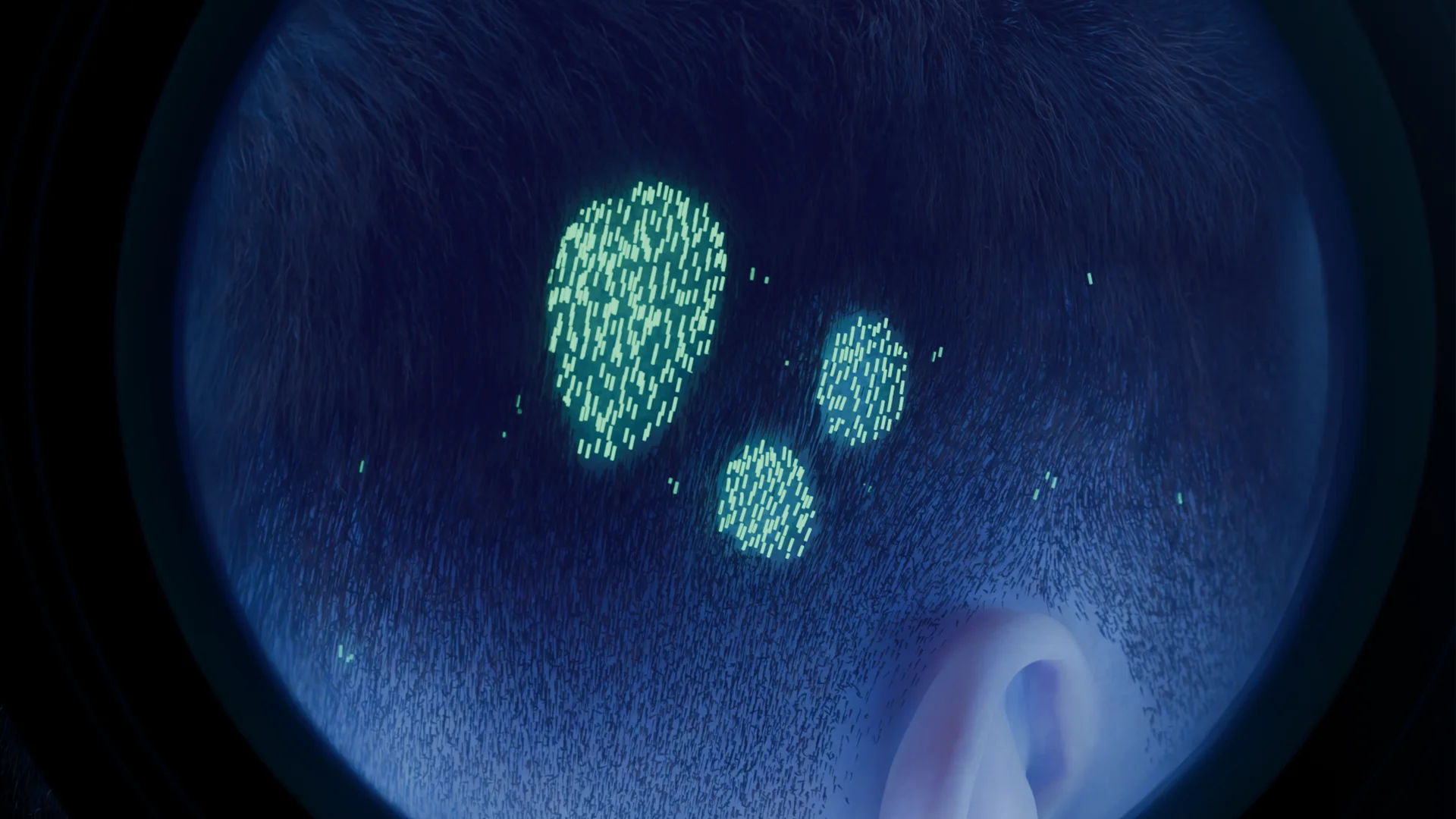 Microsporia Lesion under Wood’s Lamp Illumination