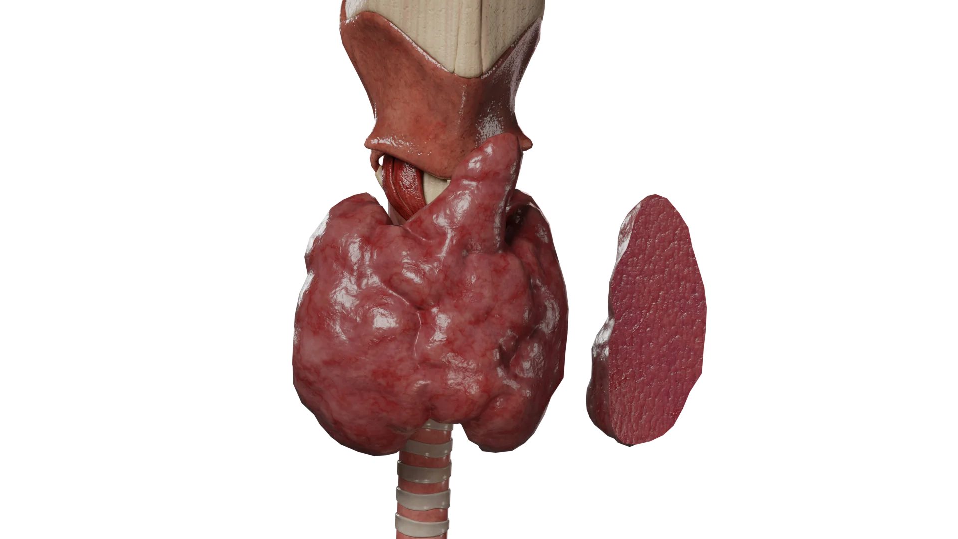 Hipertiroidismo (tirotoxicosis): síntomas, causas, diagnóstico y métodos de tratamiento