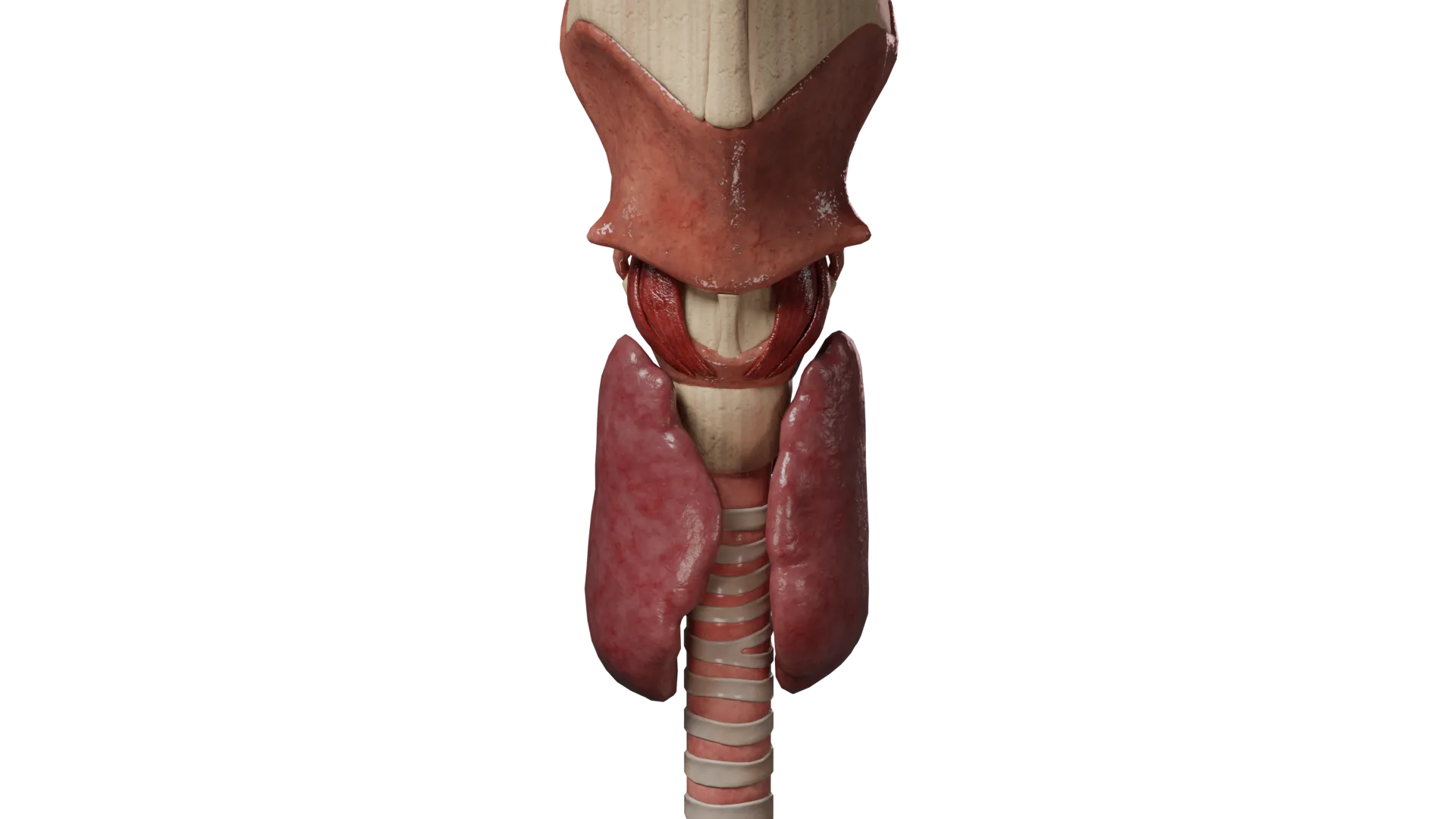 Agenesis of the thyroid isthmus
