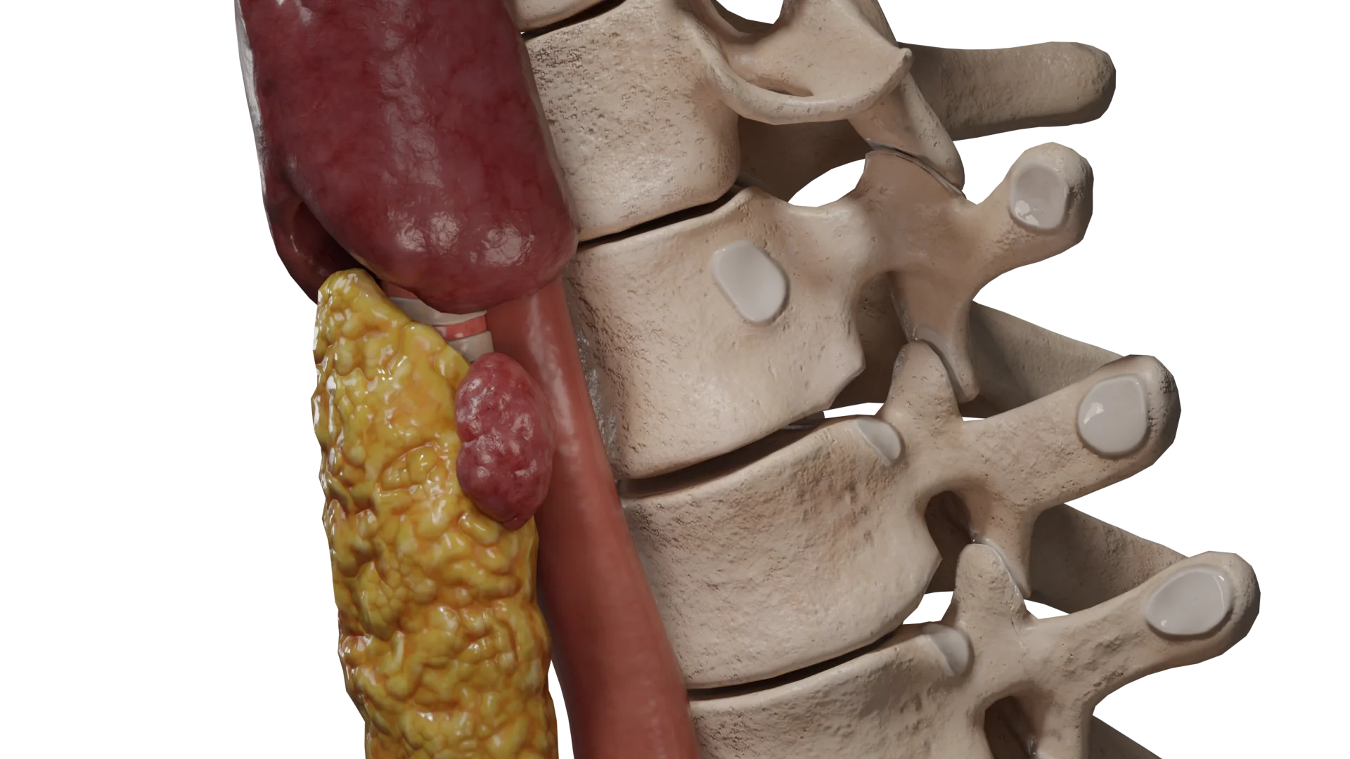 The accessory lobe of the thyroid gland