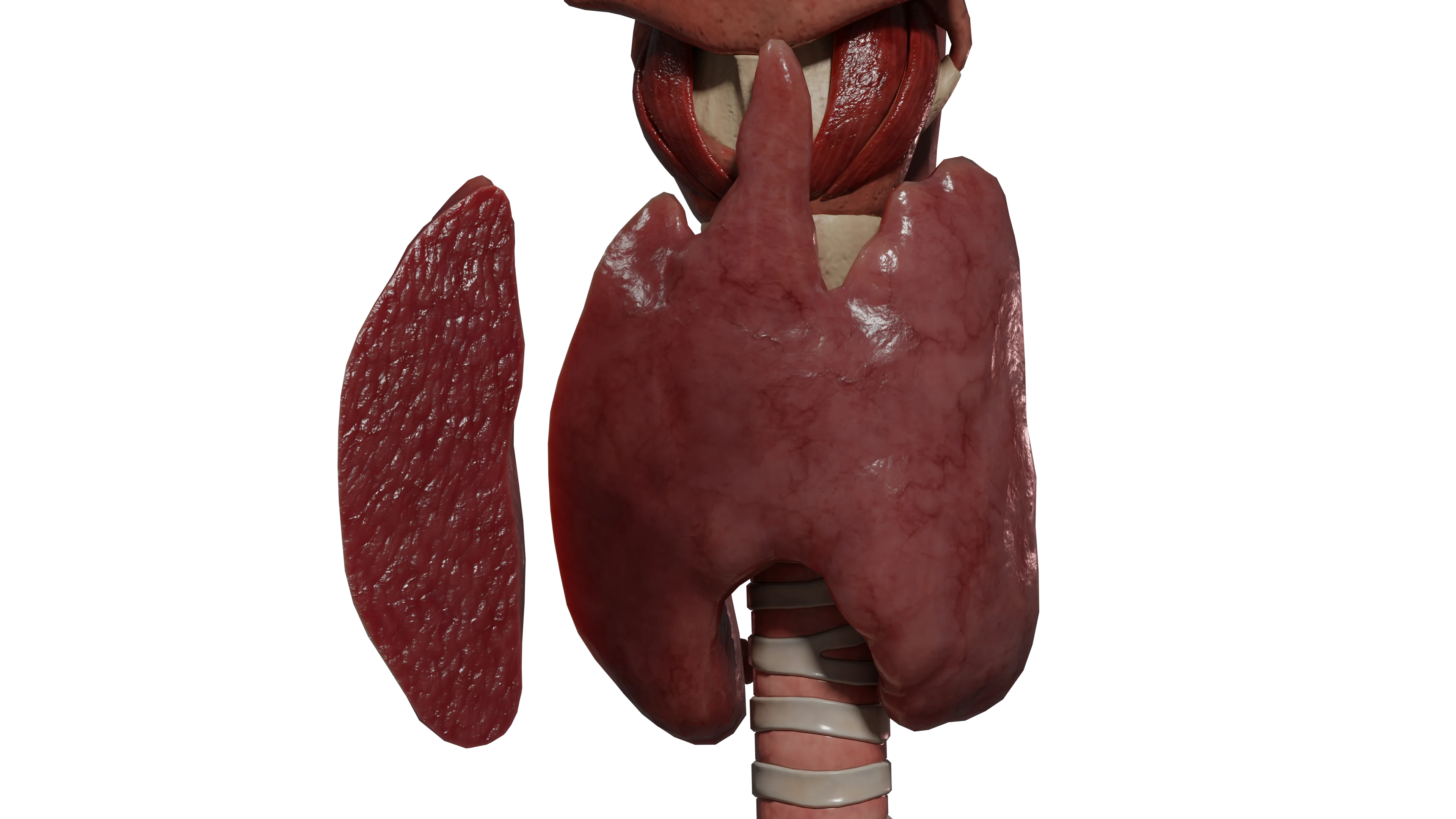 Острый диффузный тиреоидит