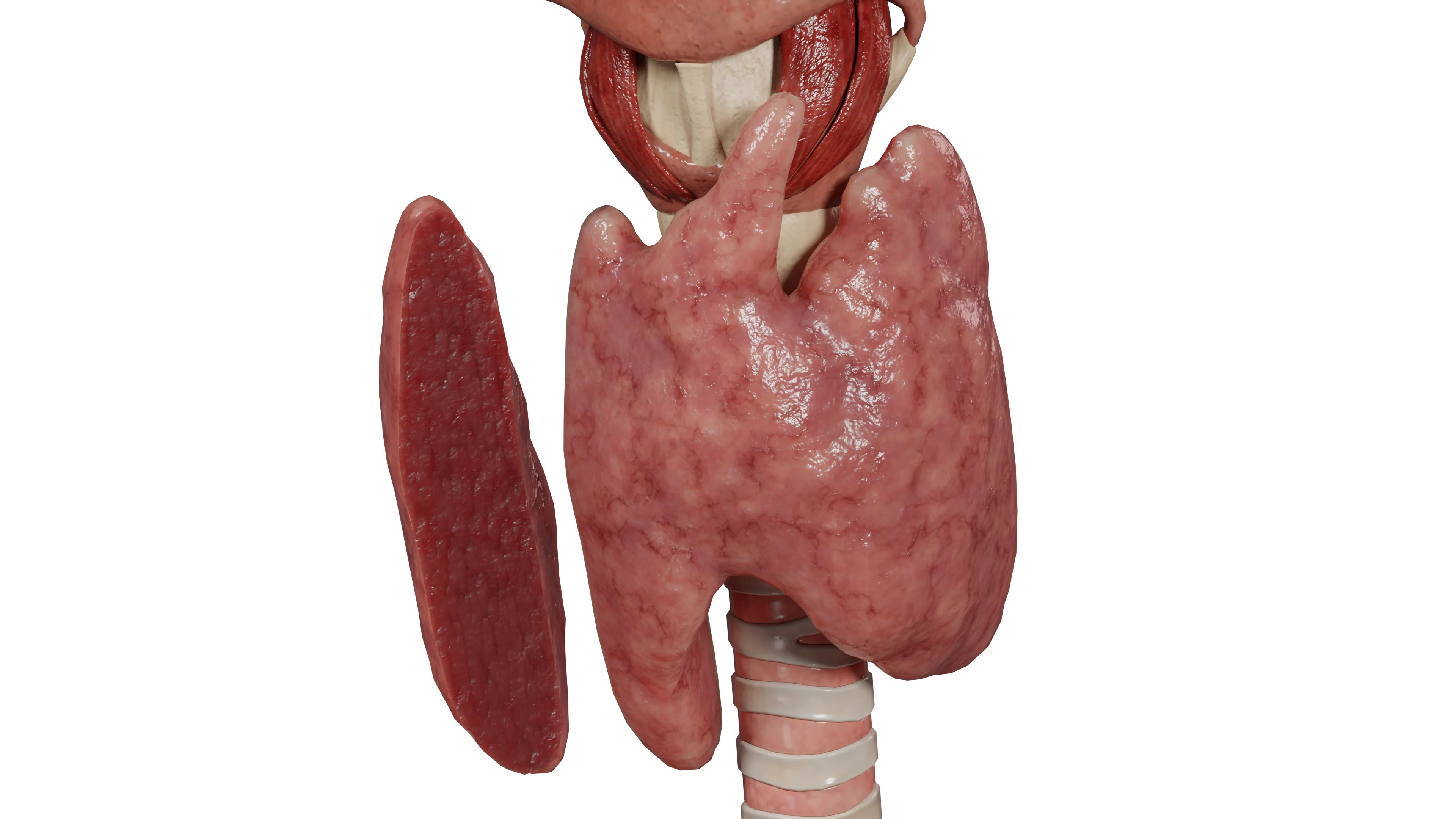 Бессимптомный лимфоцитарный тиреоидит