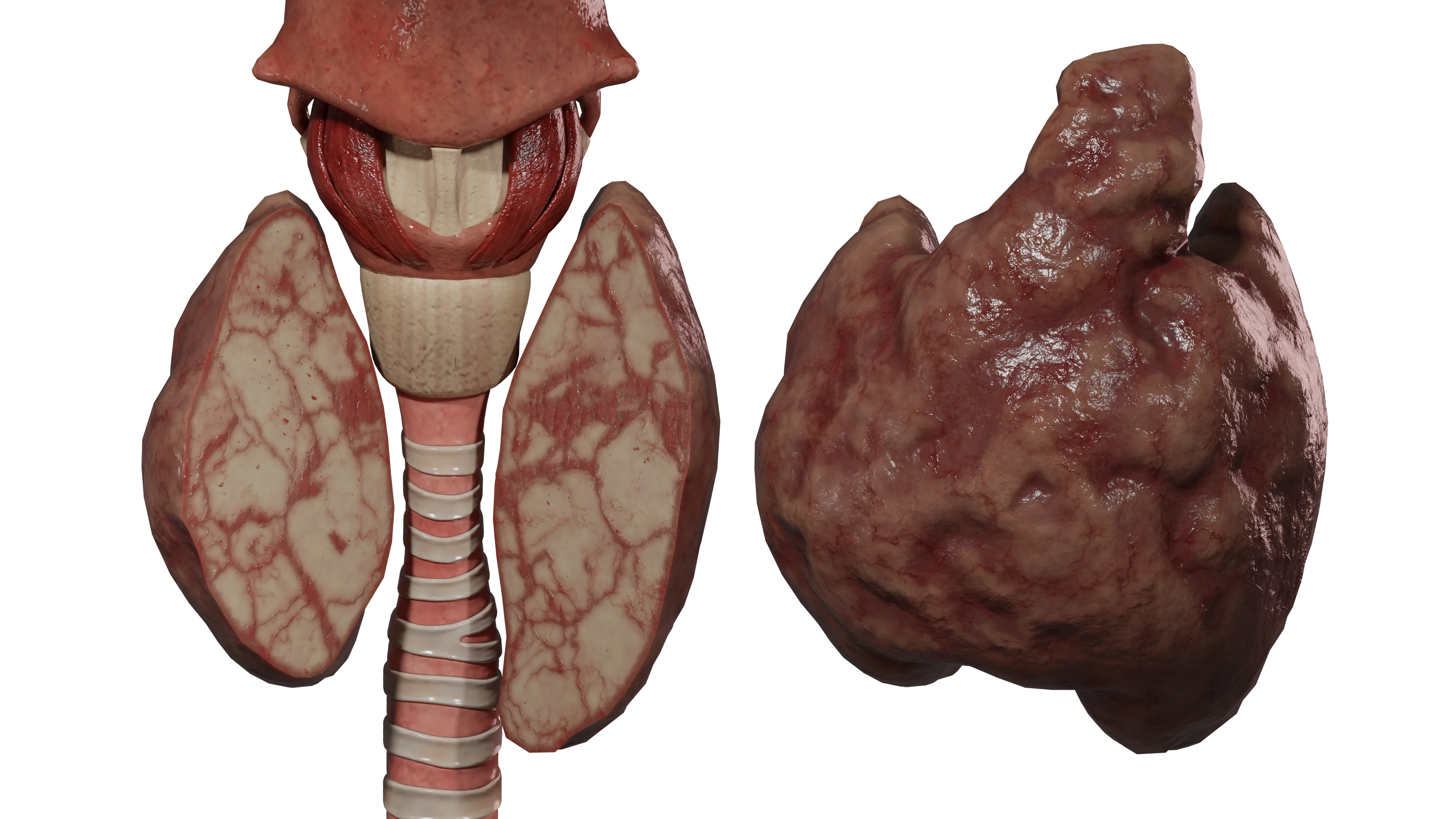 Тиреоидит: классификация, клинические симптомы, диагностика и методы лечения