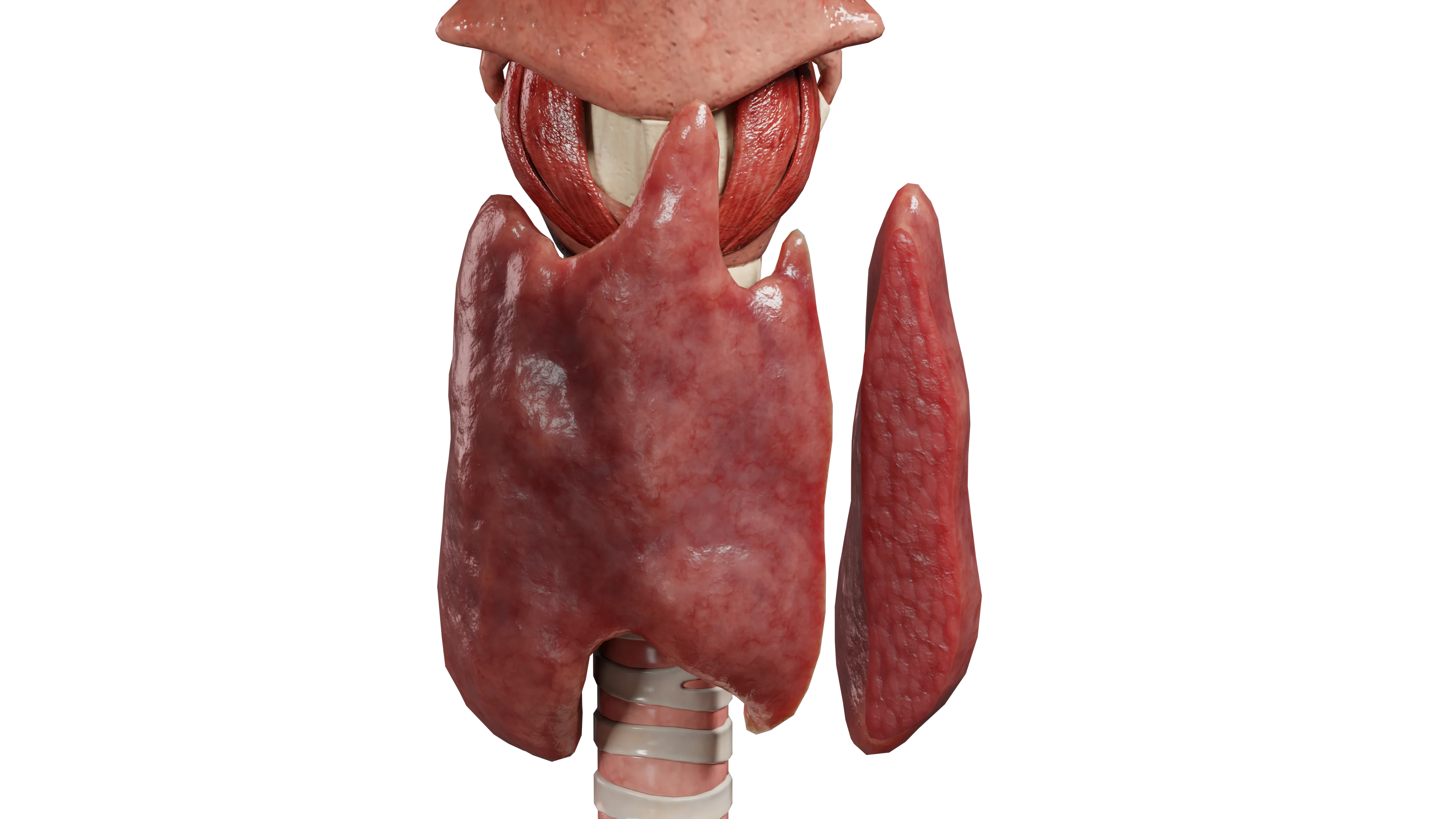 Лекарственно индуцированный тиреоидит