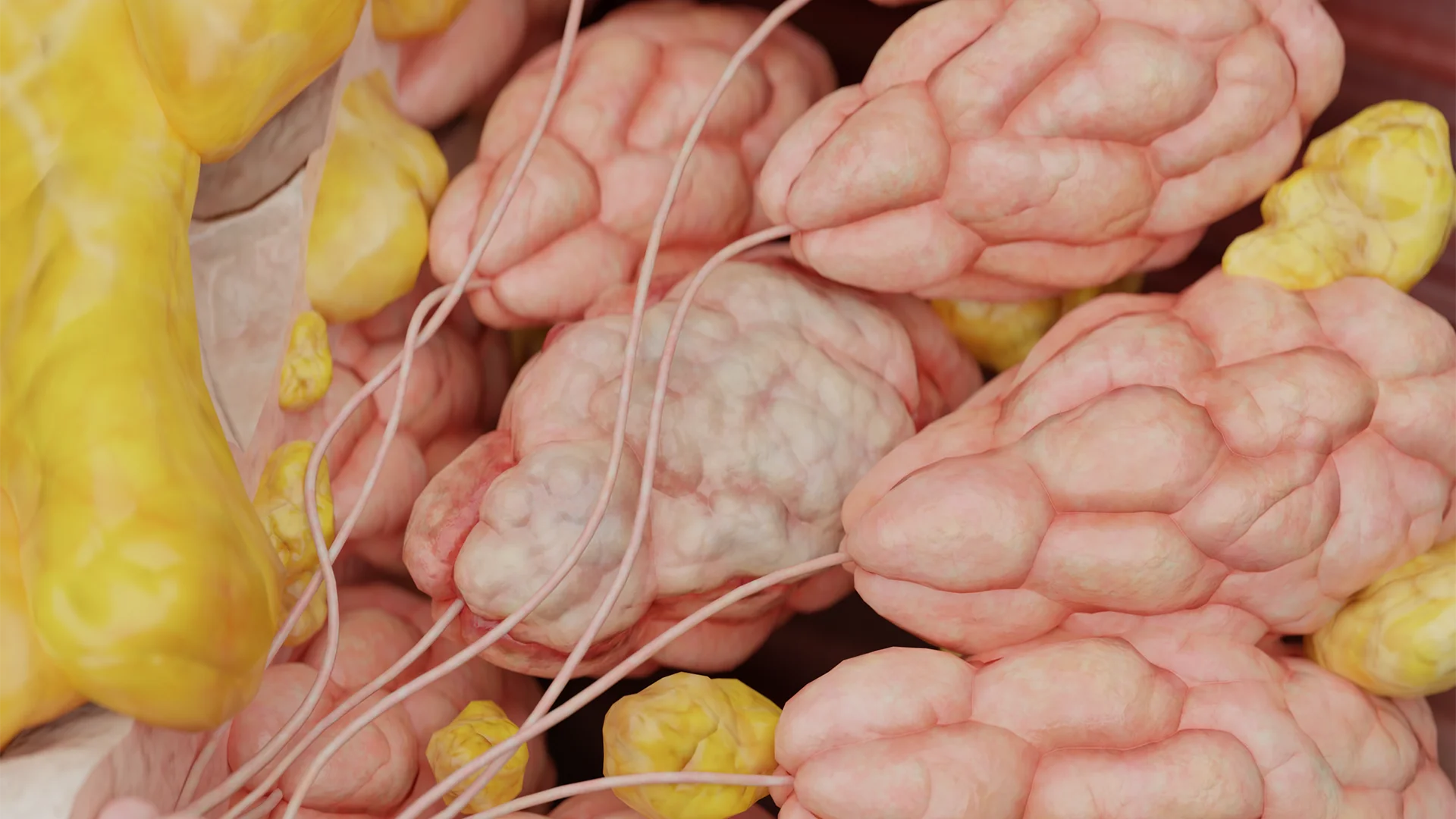 Breast fibroadenoma: aetiology, clinical presentation, diagnosis and treatment