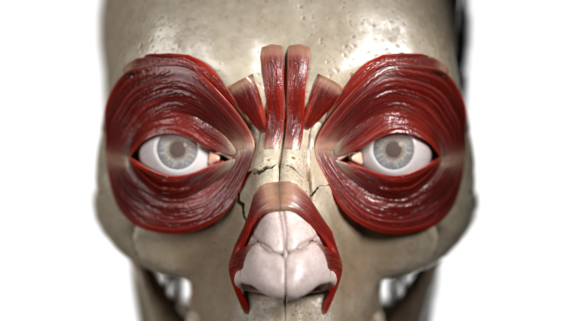 External nasal fractures: classification, symptoms, diagnosis, and treatment